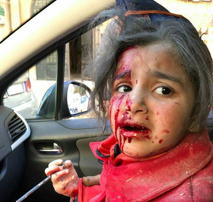 Une écolière blessée dans le bombardement de l'école Fourqane par les rebelles
