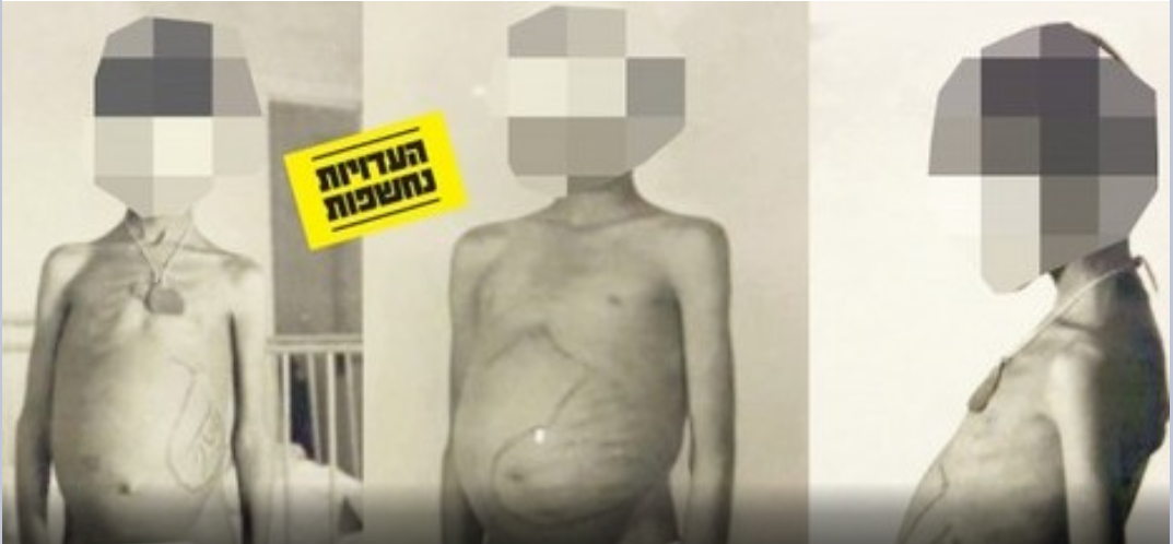 «Israël » a exposé des enfants yéménites enlevés à des essais scientifiques