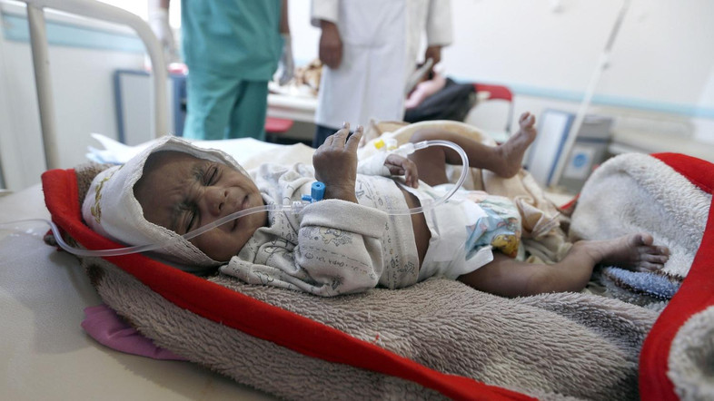 YEMEN-Cholera