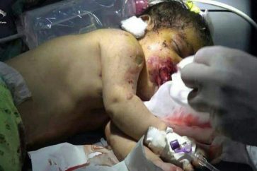 Plusieurs femmes et enfants yéménites ont été tués suite à un bombardement saoudien contre une cérémonie de mariage à Jawf