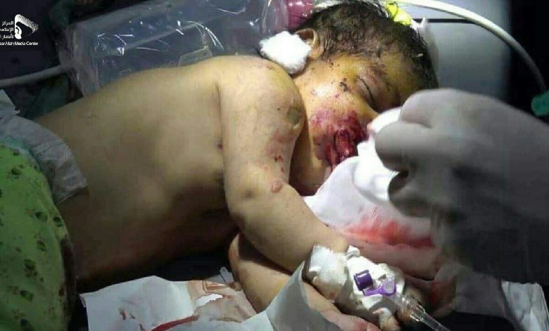 Plusieurs femmes et enfants yéménites ont été tués suite à un bombardement saoudien contre une cérémonie de mariage à Jawf