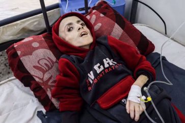 Yazan al-Kafarna, enfant palestinien décédé des suites de la faim et de la malnutrition dans l’enclave assiégée par le régime israélien. (Capture d’écran/X)