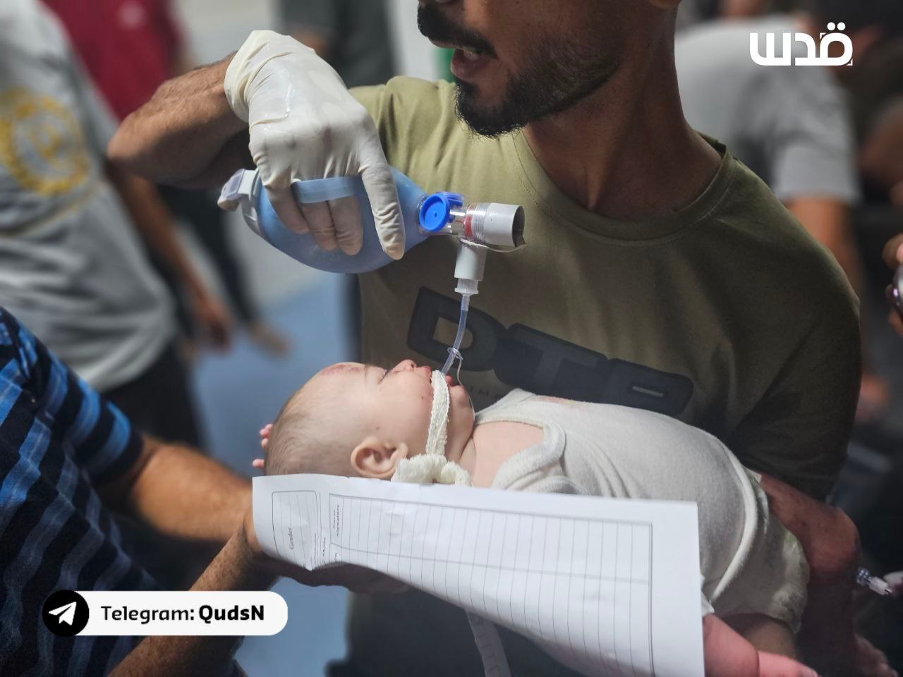 Ce bébé a été blessé dans le bombardement israélien sur l'entoutage de l'hôpital St Baptiste à Gaza city