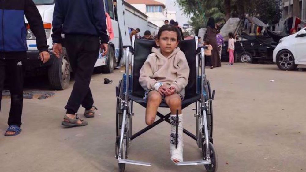 La jeune Palestinienne Eman al-Kholi a été amputé d'une jambe à la suite d'une frappe israélienne le 28 décembre 2023. ©Reuters