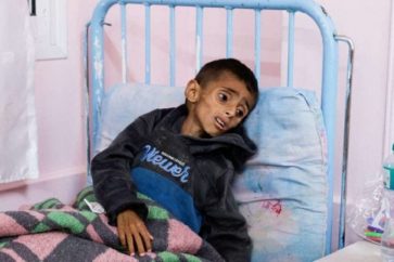 Un enfant palestinien affecté par la famine en raison du blocus israélien contre Gaza (Illustration)