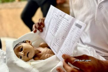 Ghadir, 5 mois, 112ème enfant martyr de la famine